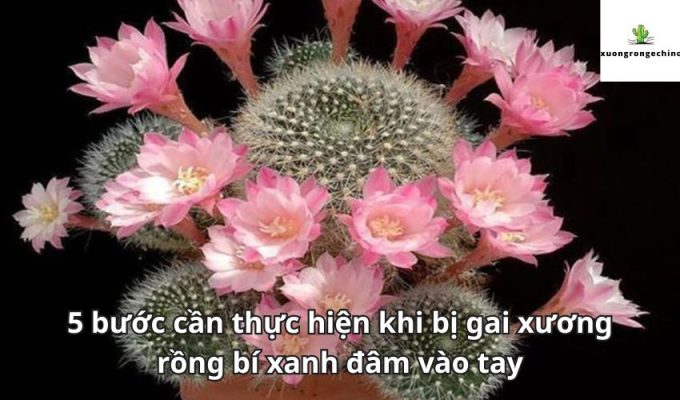 5 bước cần thực hiện khi bị gai xương rồng bí xanh đâm vào tay